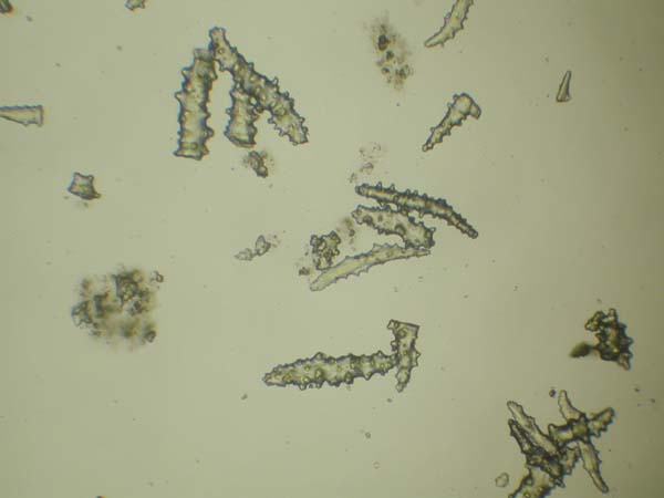 Gorgonacea Sponge Spicules.