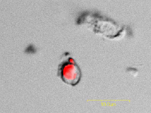 Autofluorescent bacteria from a sponge cell transmitted light and Krypton Laser